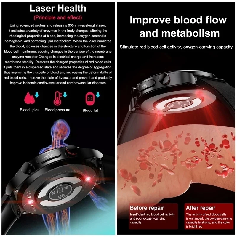 2025 New For XIAOMI 1.49"AMOLED Screen Laser therapy Smart Watch Men Women Blood fat Uric acid ECG+PPG Health Tracker Smartwatch 2