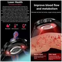 2025 New For XIAOMI 1.49"AMOLED Screen Laser therapy Smart Watch Men Women Blood fat Uric acid ECG+PPG Health Tracker Smartwatch 2