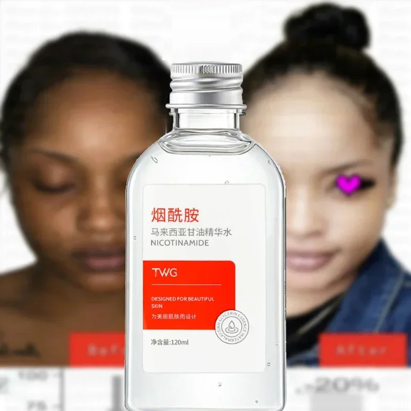 Niacinamide Malaysian Glycerin Liquid Brighten Skin Colour Dryness Relief Essence Hydrating Moisturizing Essence Free Shipping