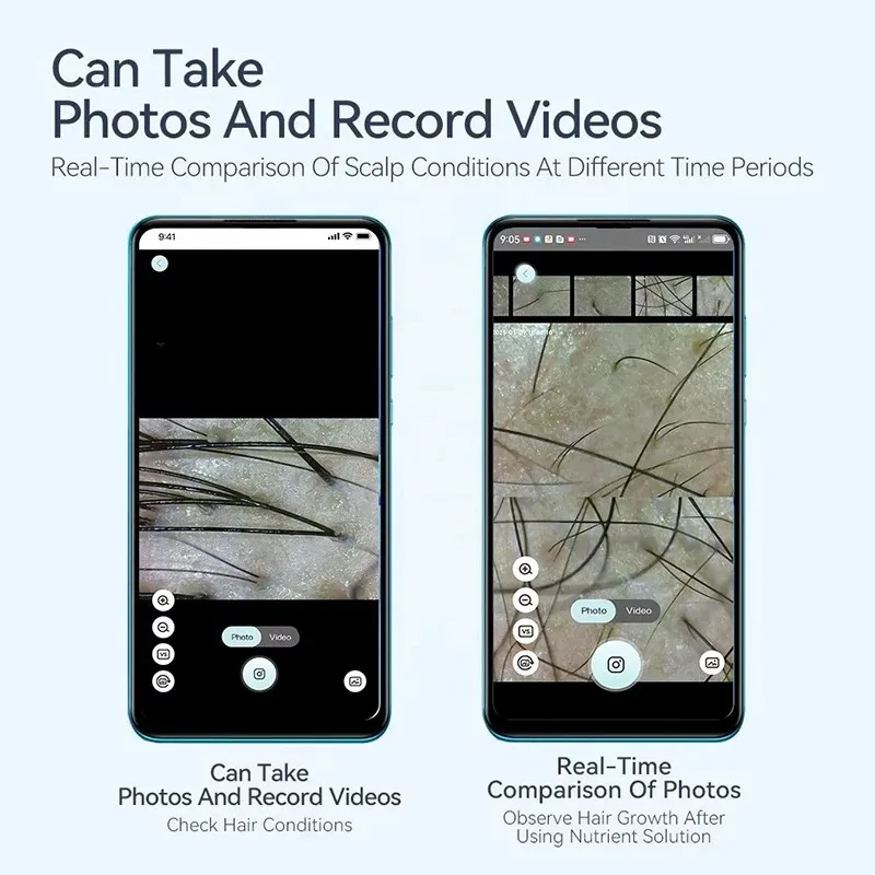 Electron Scalp Detection Pore Magnifier For Face Digital Microscope Camera Dermatoscope Skin Analyzer Machine Head Skin Analysis