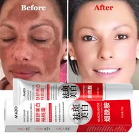 Crème blanchissante puissante anti-taches, éclaircissante pour la peau, élimine rapidement la Pigmentation de la mélanine, mélasma, taches foncées, soins coréens pour la peau 2