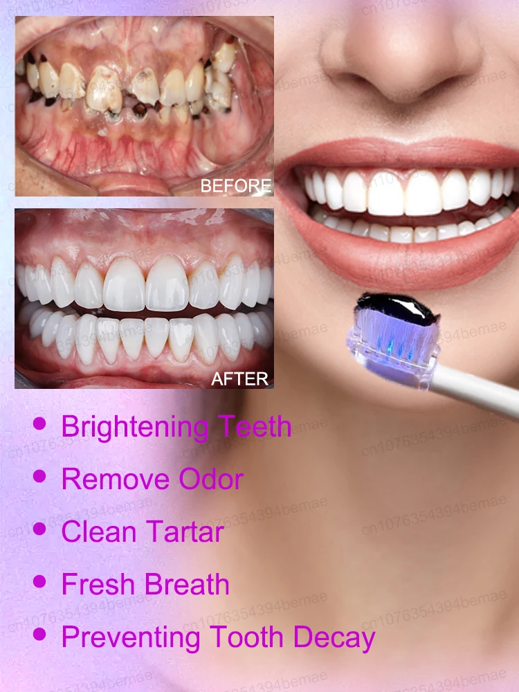 Toothpaste Whitening Teeth Repair Teeth White Brightening Tooth Care Purple Corrector Toothpaste Reduce Yellowing