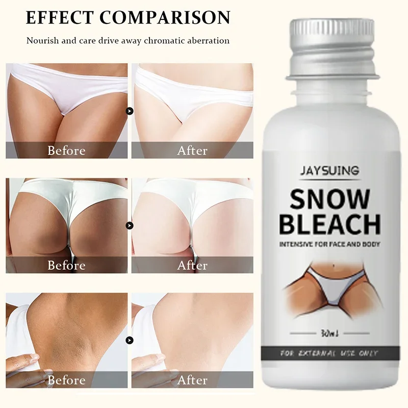 Whitening Cream For Dark Skin Armpit Thigh Inner Joint Lightening Intimate Area Underarm Body Care Private Parts Brighten Lotion whitening lotion