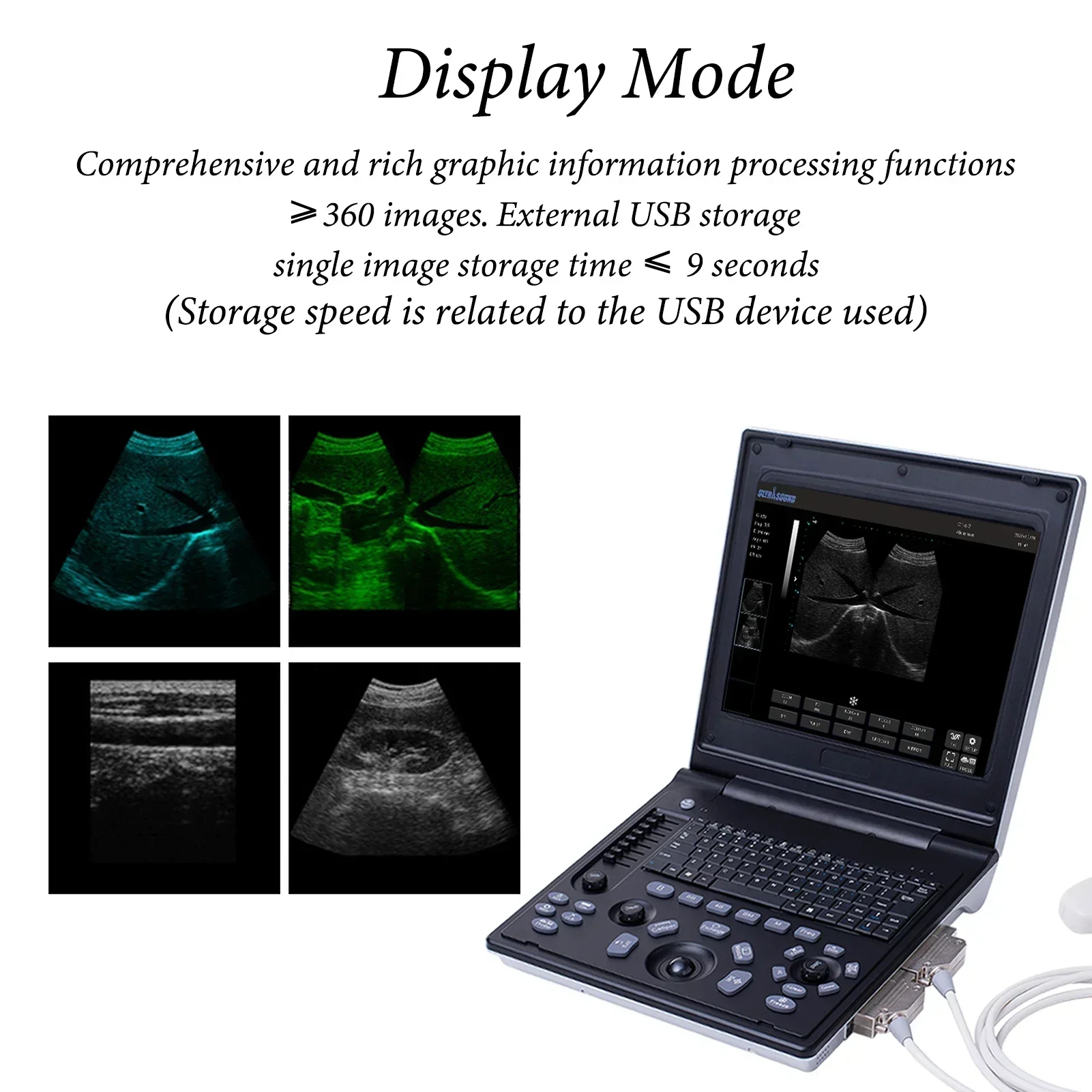 Veterinary B-Ultrasound Machine with 3.5 MHz Micro Convex Probe for Pregnancy Cat Dog Goat Cow Pig Portable Laptop Scanner
