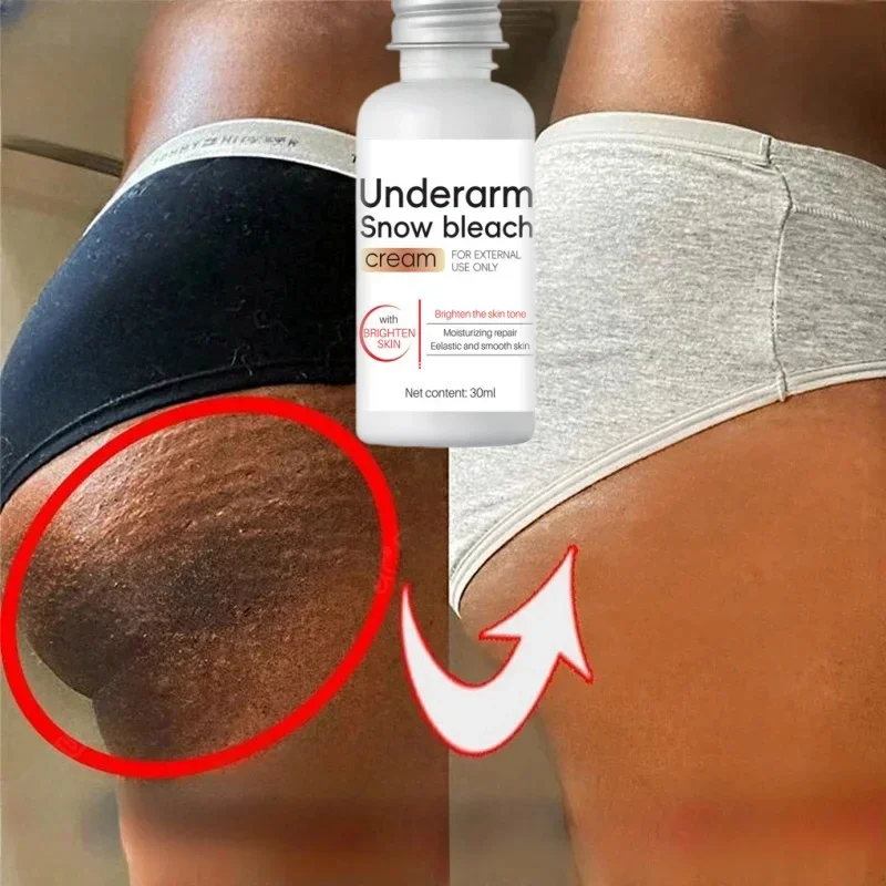 Whitening Cream Private Parts Underarm Bleaching Serum Whiten Butt Knee Brighten Inner Thigh Intimate Parts Dark Remove Melanin whitening body cream whitening cream brightening cream whitening serum brightening body cream