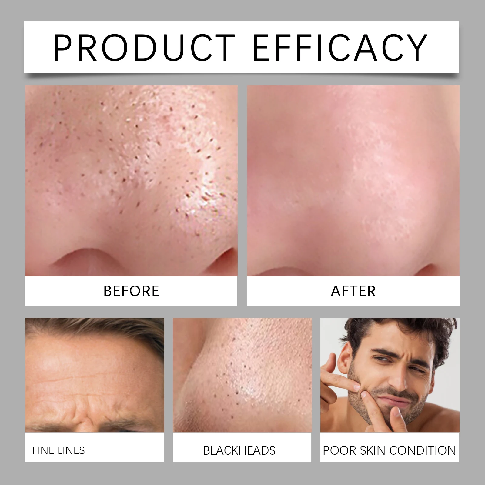 volcanic mud cleaning soap removes blackheads and acne, cleanses facial keratin, moisturizes the skin, and cleanses the face