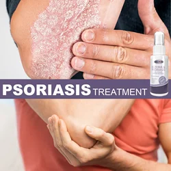 Herbal Antibacterial Spray Anti-itch Psoriasis Dermatitis Eczema Essence Rash Urticaria Desquamation Treatment Body Skin Care