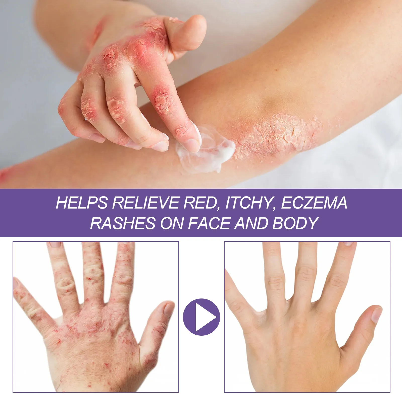 Рисунок 4 - Восстанавливающий крем от псориаза