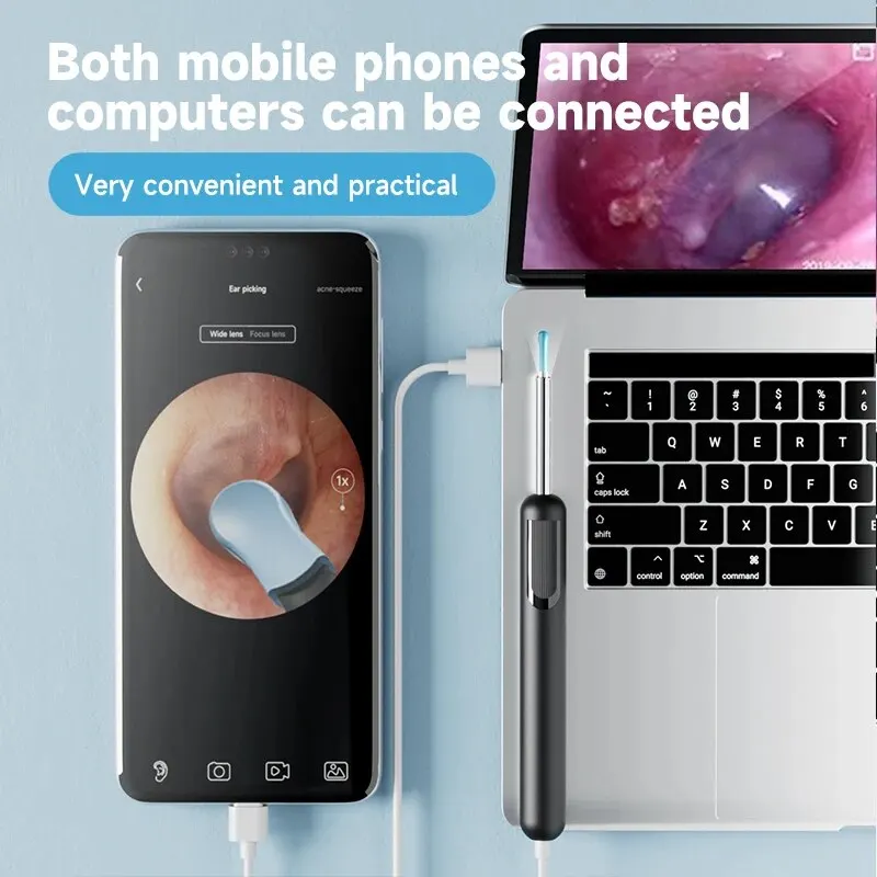 Ear Wax Cleaner Ear Wax Removal Tool Smart Ear Cleaner Camera Scope with Light Smartphone HD Video Otoscope Wax Cleaner For Android PC