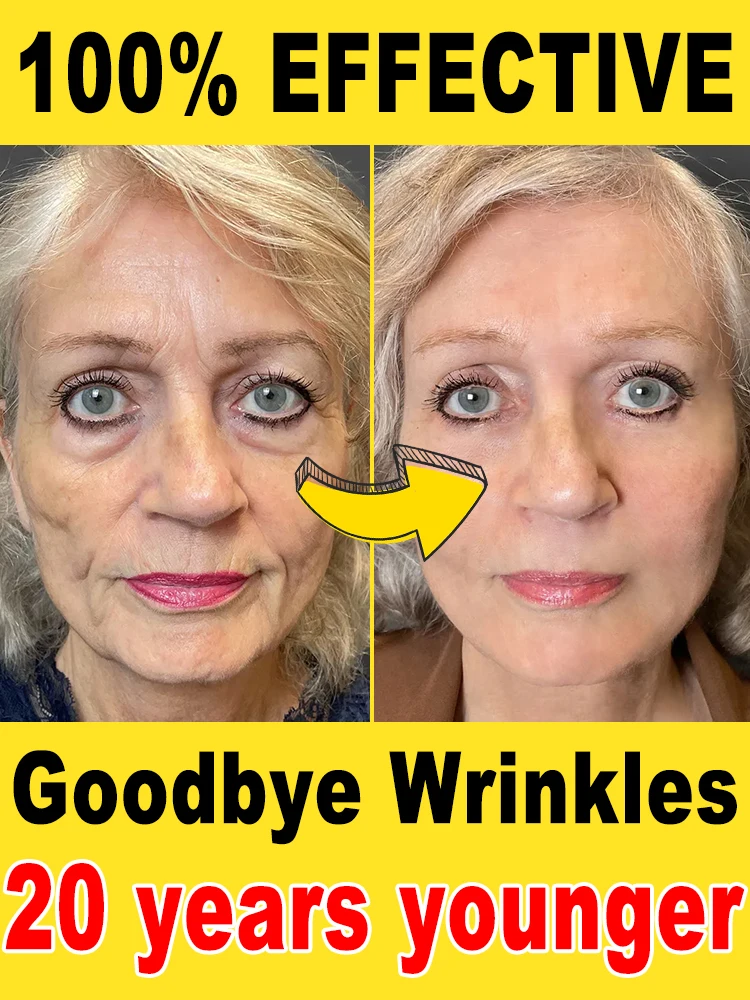 wrinkles disappeared，20 years younger, no fine lines
