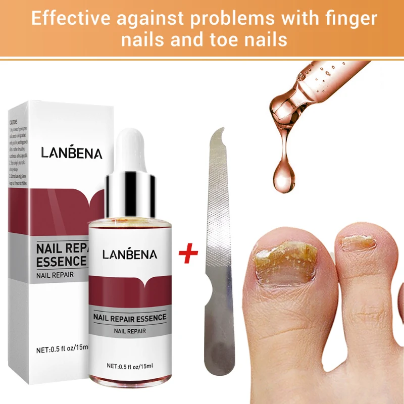 

Beauty Health Nail Repair Essence Serum Fungus Removal Nails Gel Anti Infection Paronychia Onychomycosis Hand Foot Nails Care