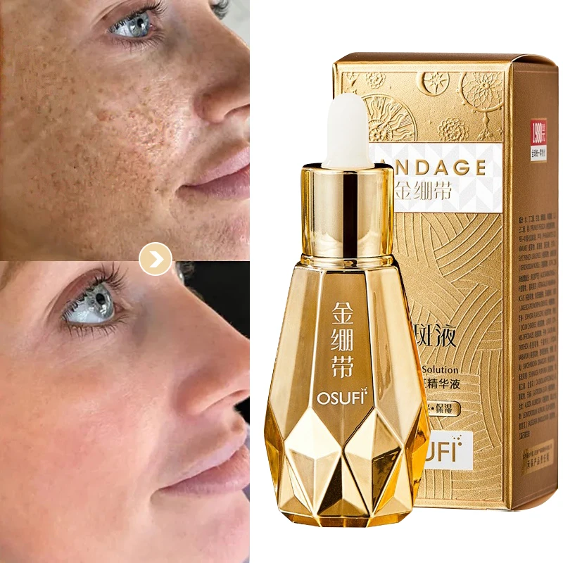 Freckle Removing Whitening Serum Black Spot Melasma Remover Anti-Age Spots Pigment Deposition Moisturizing Skin Care 60ml