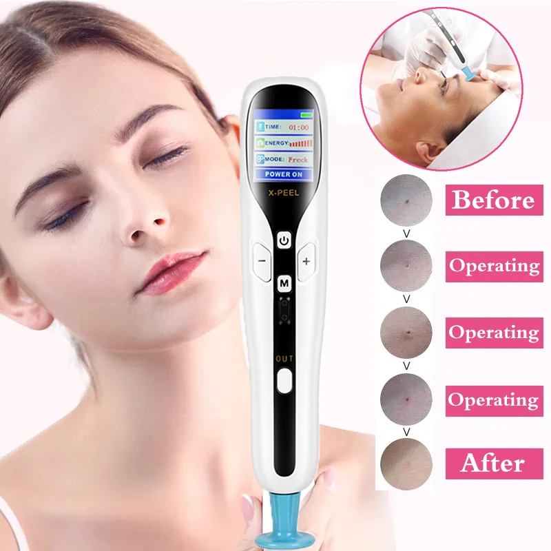 

3 in 1 Ozone Plasma Mole Removal Pen Professional Tattoo Remove Tool LCD Skin Tag Freckle Black Dot Wart Pimple Remover Machine
