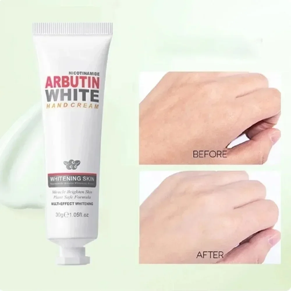 نياسيناميد أربوتين كريم تبييض لليدين ، إزالة التجا...