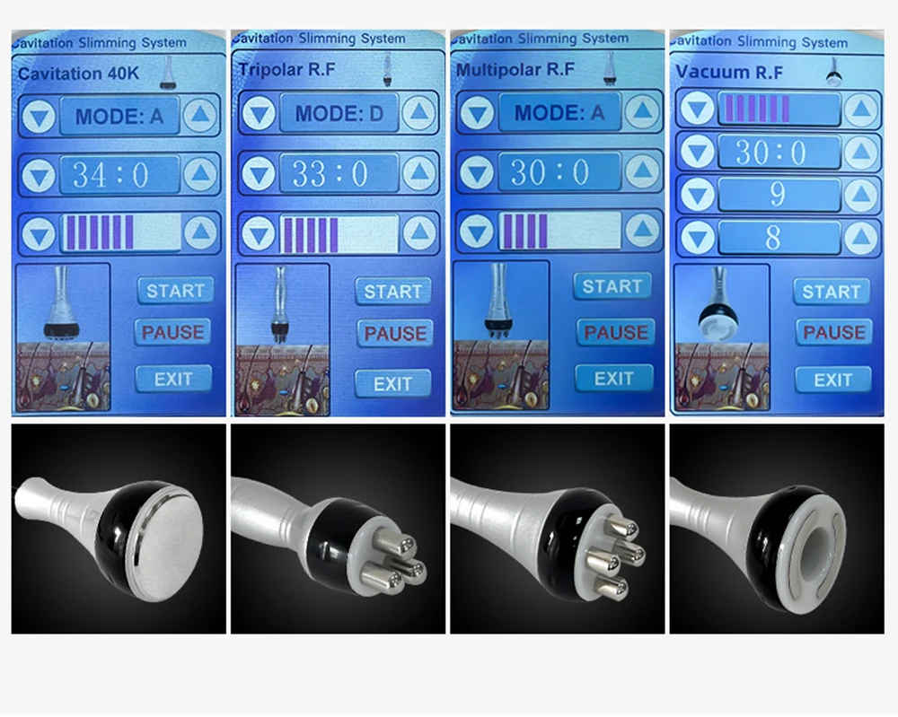 超音波キャビテーション装置,無線周波数,40k,カートリッジ,スパ