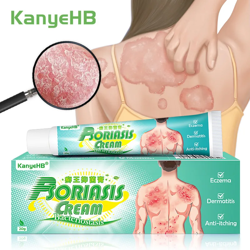 Skin Care Ointment 10pcs Psoriasis Eczema Treatment Anti-itch Cream
