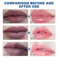 Remove Dark Lip Balm Fast Lightening Pink Lip Exfoliating Fade Lip Line Dead Skin Moisturizer Korean Care Products Beauty Health 2