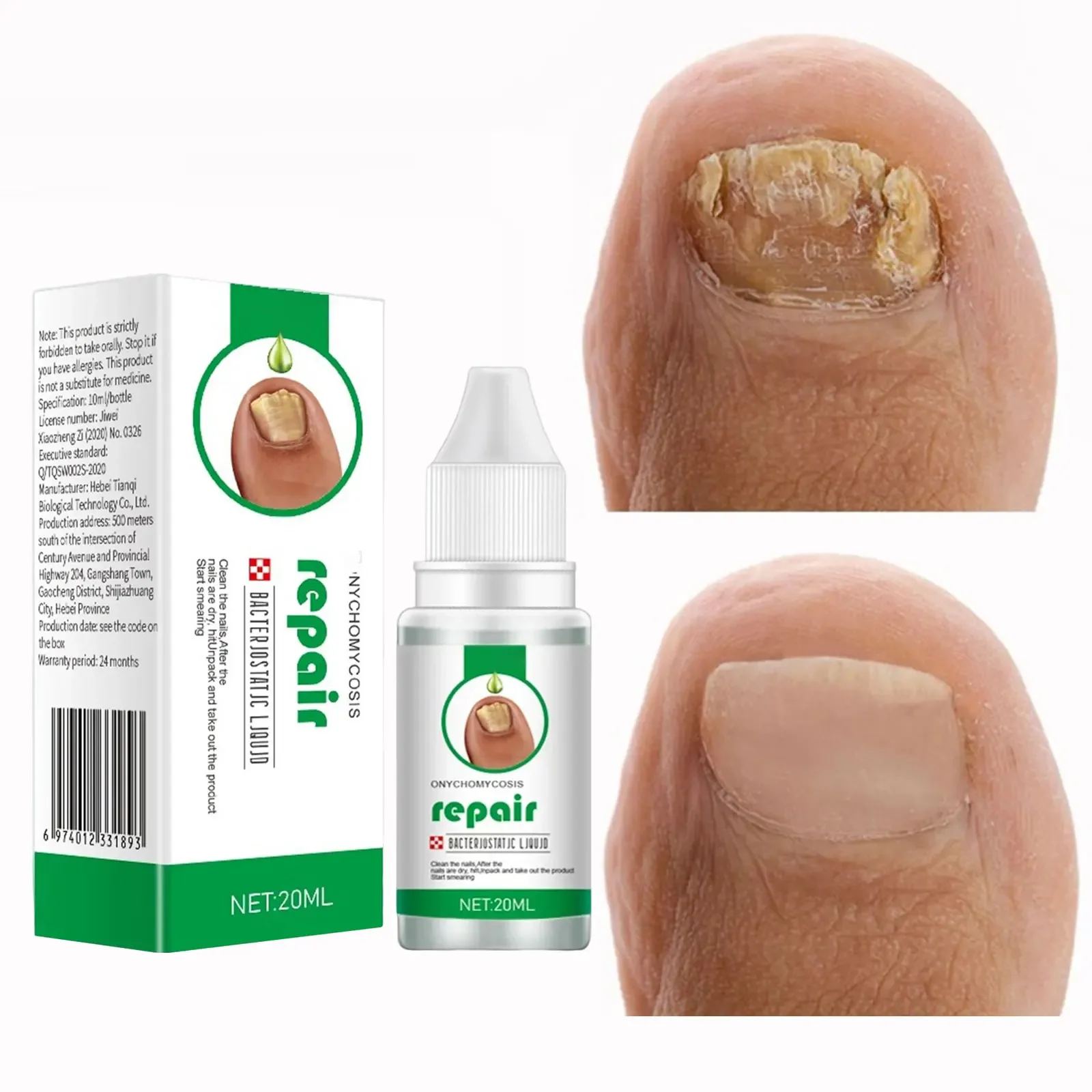 Nail Fungus Treatment 20ml Nails Repair Essence Liquid Renew Damaged Broken Cracked & Discolored Nails for Damaged Nail U&ntilde;as