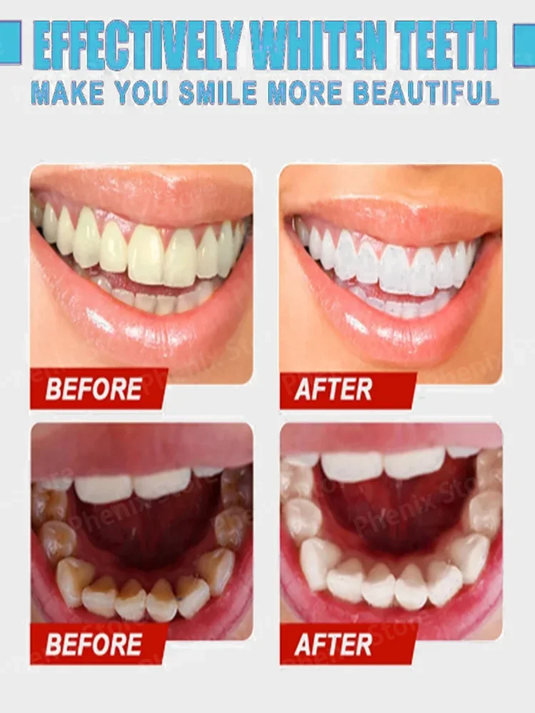 Teeth Whitening Product Tooth Decay Repair
