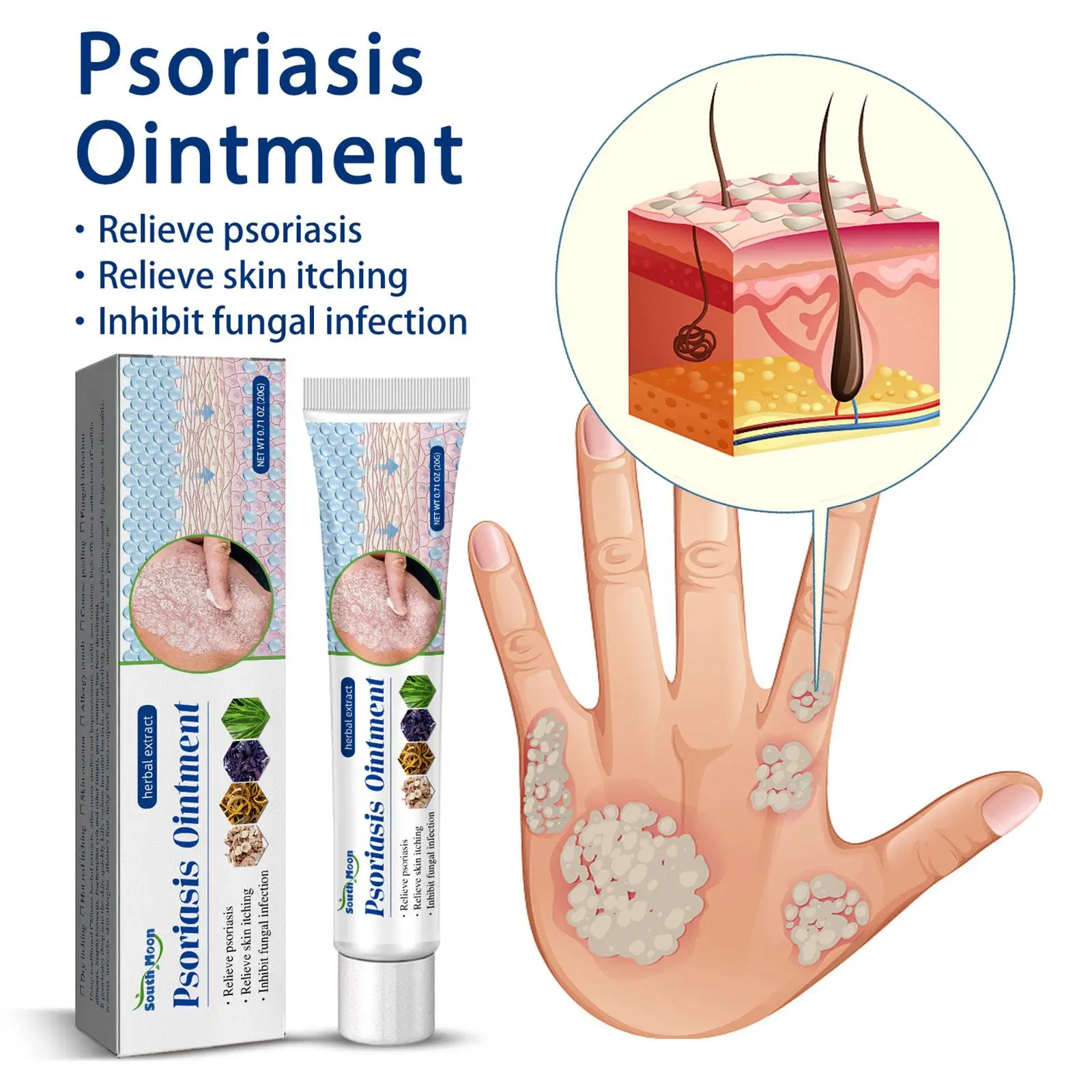 Herbal Psoriasis Treatment Cream Antibacterial Anti-itch Dermatiti Eczema Urticaria Alergy Skin Ointment Beauty Health Body Care skin care ointment antibacterial anti fungal cream