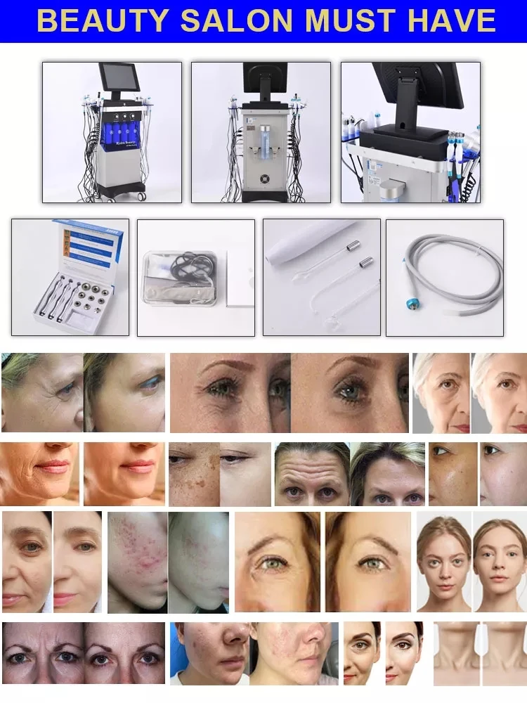 14 az 1-ben Hydrafacial bőrápoló gép – gyémánt dermabrázió és vízsugaras Aqua arckezelés SPA- és szépségszalonokhoz [Hydrafacial, dermabrázió]