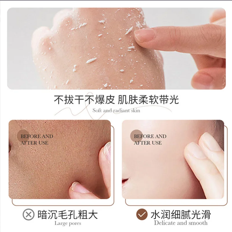Hydrolyzed Rice Face Exfoliating Cream Whitening Moisturizer Repair Facial Scrub Cleaner Acne Blackhead Treatment Remove Cream