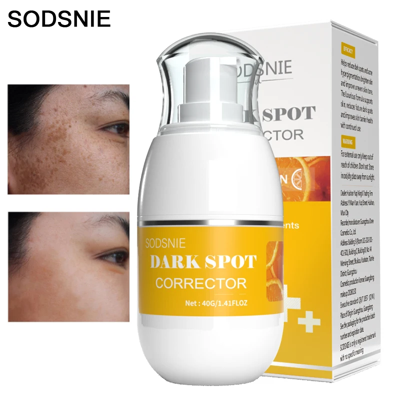 

Anti-Dark Spots Freckle Cream Niacinamide Whitening Brightening Skin Tone Lightening Pigmentation Repair Moisturizing Facial 40G