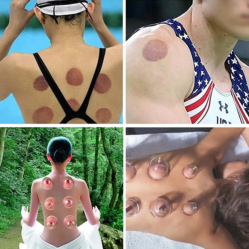 Cupping Therapy Set Vacuum Cupping Set Suction Cups Massage Physiotherapy Jars Chinese Medicine Anti Cellulite For Body Massager 5