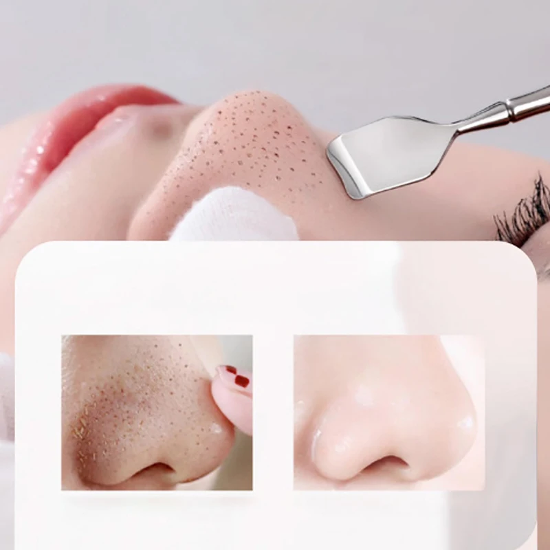 Blackhead Remover Two-sided Spatula Nose Face Blemish Pore Cleaner Beauty Health Salon Special Acne Tool