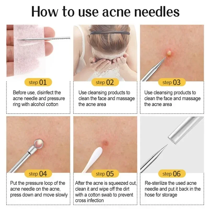 11Pcs Acne Needle Professional Tweezers Acne Remover Ultra-fine No. 5 Cell Pimples Blackhead Clip Facial Pore Cleaning Care Tool 6