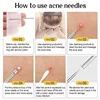 11Pcs Acne Needle Professional Tweezers Acne Remover Ultra-fine No. 5 Cell Pimples Blackhead Clip Facial Pore Cleaning Care Tool 6