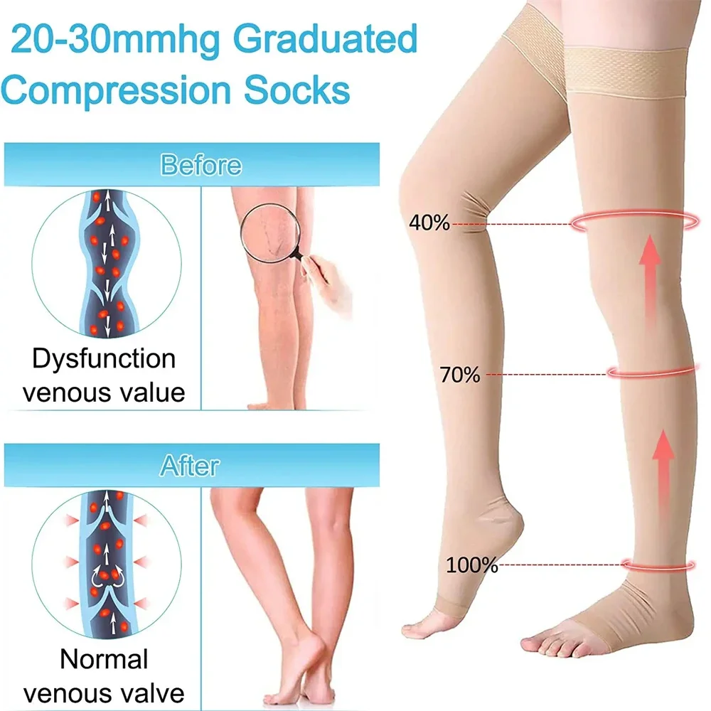 Open Toe Thigh High Compression Stockings with Silicone Band for Women Men 20-30 mmHg Graduated Support for Varicose Veins 1Pair