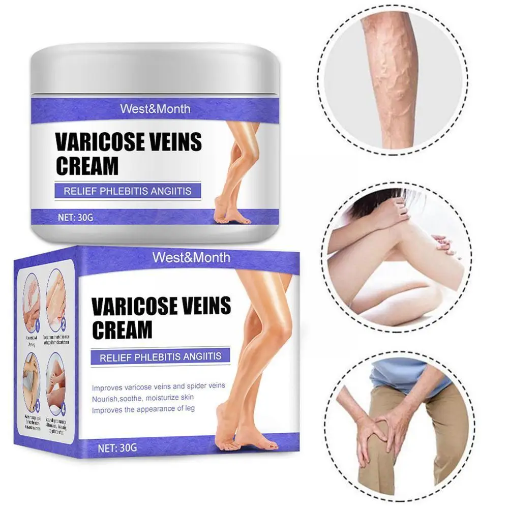 

30g Varicose Vein Cream Effective Varicose Veins Relief Relieve Pain Spider Treatment Phlebitis Vasculitis Cream Ointment X0V8