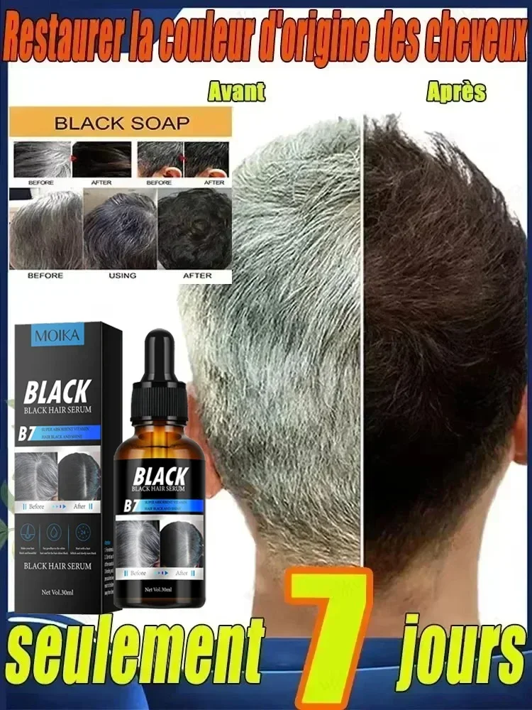 Hair Treatment Turn White Hair into Black Remove Gray Hair in 7 Days