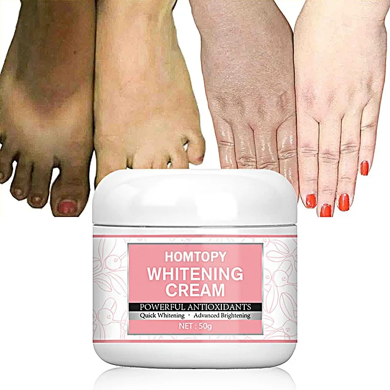 

Body Whitening Cream Underarm Legs Knee Elbow Private Parts Brighten Armpit Bleaching Cream Remove Dark Spots Melanin Skin Care