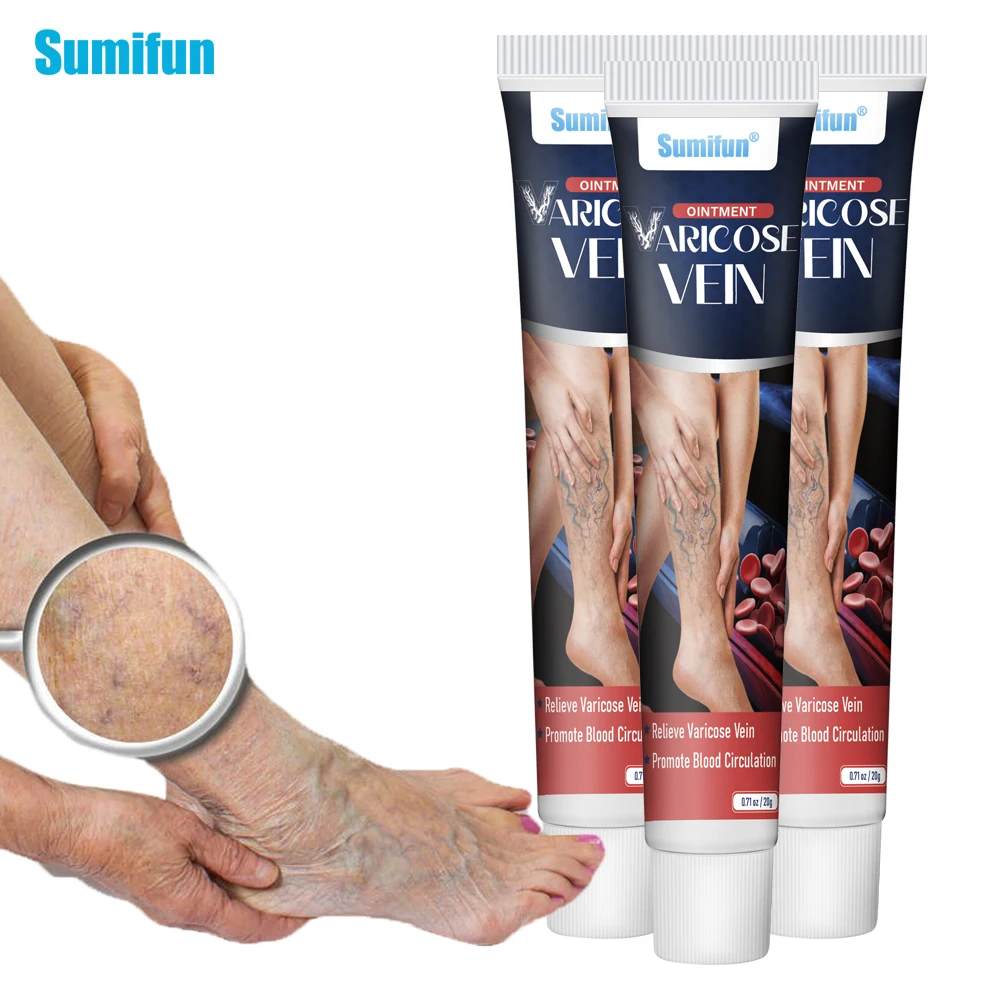 

1/2/3Pcs Sumifun New Varicose Vein Cream Phlebitis Vasculitis Spider Removal Plaster Varicosity Angiitis Pain Relief Ointment