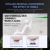 DAMMAN 15g Grafting Eyelash Extension Glue Cream Remover Non-irritating Clear Up Lashes Gel Remover Adhesive For Makeup Tools 3