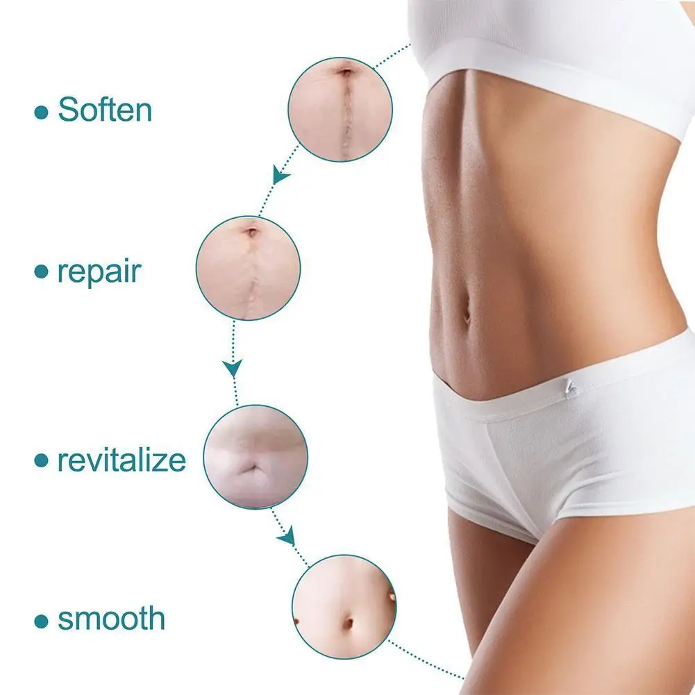 Acne Surgical Stretch Marks Removal Scar Cream Pimples Skin Acne Self-adhesive Tape Repair Tone Gel Spot Patch Face Burn E8L7