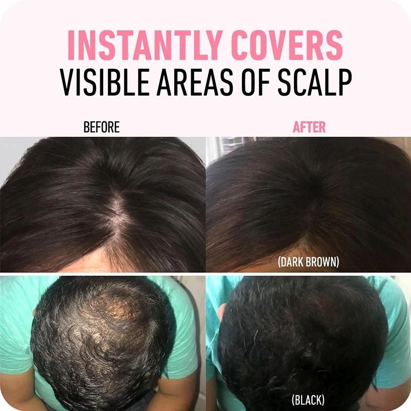 Hair Line Powder 4g Black Root Cover Up Natural Instant Waterproof Hairline Shadow Powder Hair Concealer Coverage 14 color 5