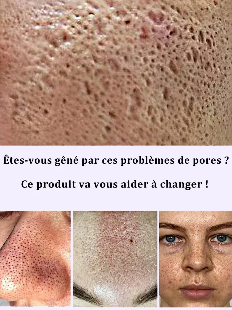 Pore Shrinking serum Essence Shrinking Pores Lactobionic Acid Shrinking Pores Facial Essence Firming Facial Pores Repair