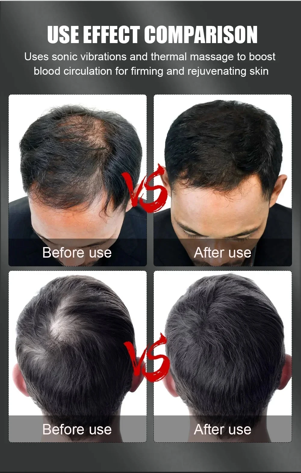 New 96Pcs Infrared LEDs 660nm&850nm Red Light Therapy Hair Growth Cap for Hair Regrowth Anti Hair Loss Relax Scalp Hair Care Hat