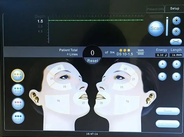 SMAS 고품질 스킨 케어 기계, 주름 방지, 피부 스트레칭, 바디 쉐이핑, 스킨 케어, 바디 슬리밍, 안티 에이징