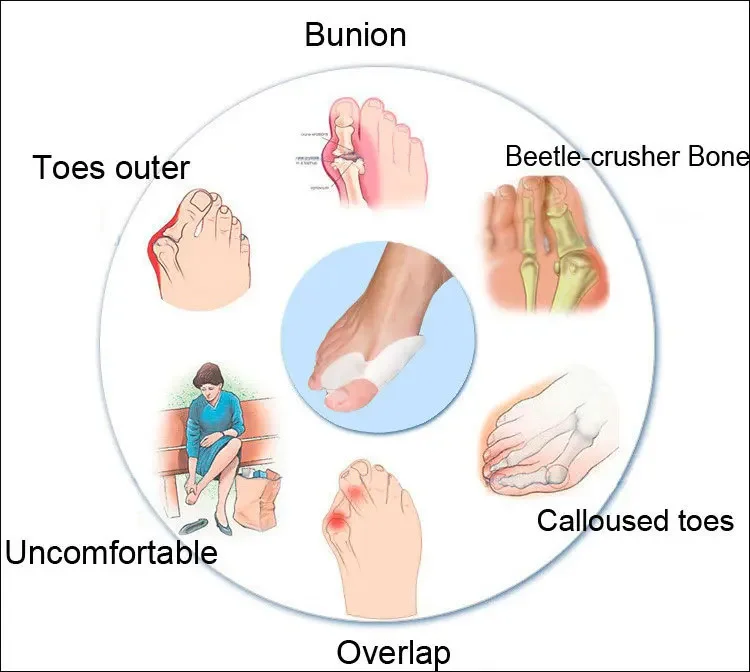 1pair Soft Silicone Gel Foot Fingers Toe Separator Alignment Bunion Pain Relief Bone Ectropion Straightener Health Care Product toe separators toe spreader finger toe separator