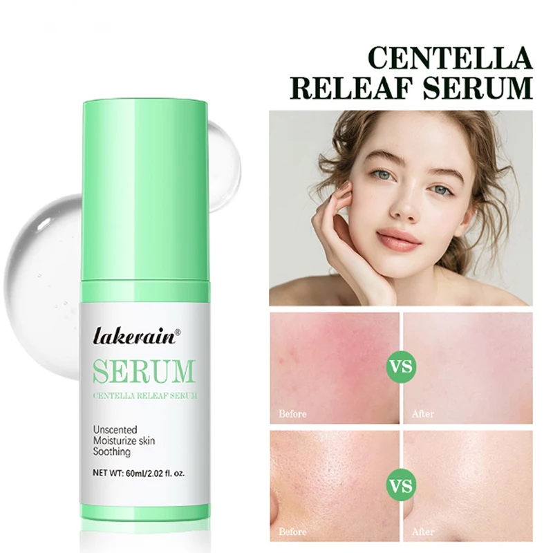 Centella Toner 60ml Moisturizing Keratin Care Quickly soothes Unscented Gentle Essence Toner Hydrating korean Facial skinCare 2