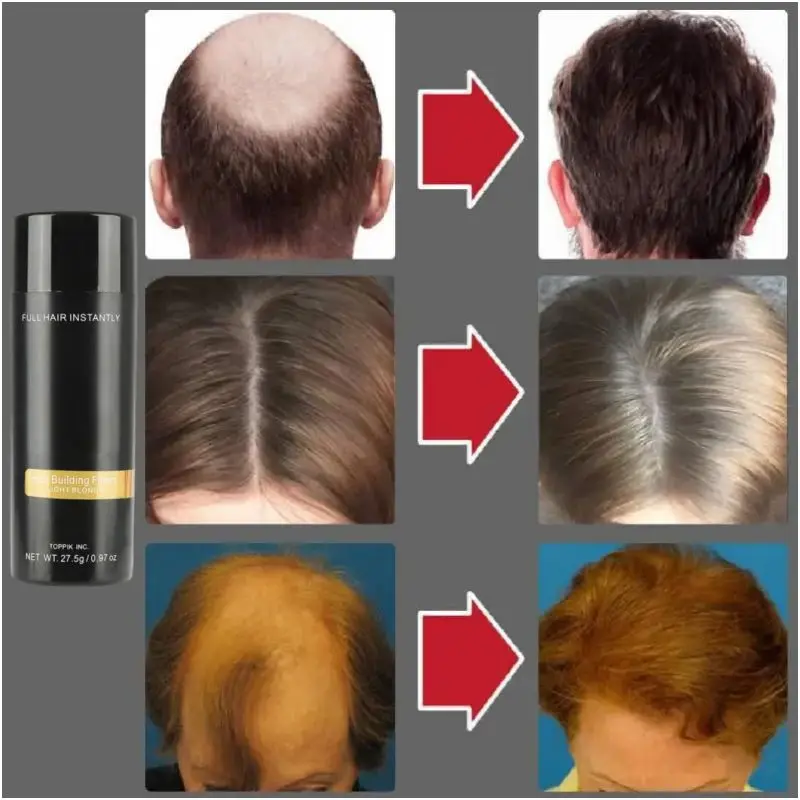 Hair Building Powder, Hair Building Fibers, Toppik Hair Loss Regrowth Powders with Applicator