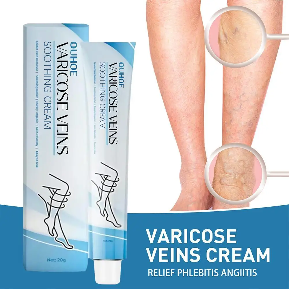 Improve Blood Circulation Varicose Veins Treatment Cream Reduce Leg Swelling Wellness Cream Soothes Tired