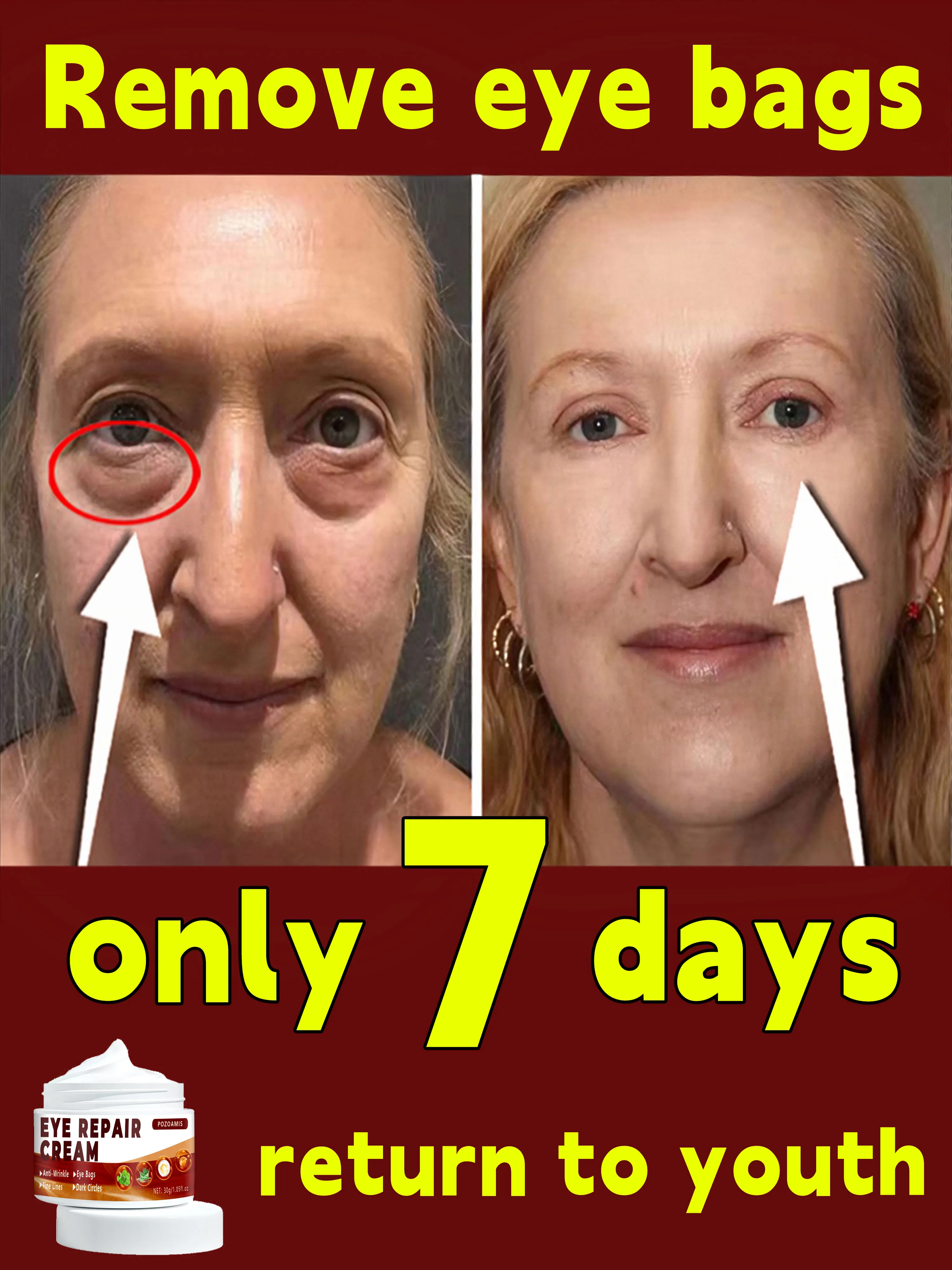 Eye cream eliminates puffiness dark circles eye bags moisturizes repairs healthy eyes eye cream