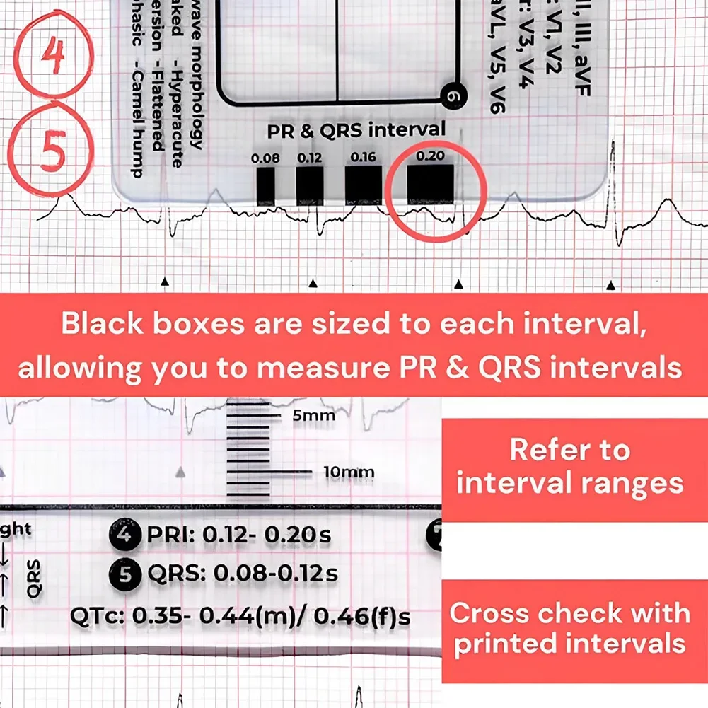 1-3Pcs ECG 7 Step Ruler ECG Guide Measurement Tool for ECG/EKG Interpretation Portable Pocket-Sized EKG Measuring Cards