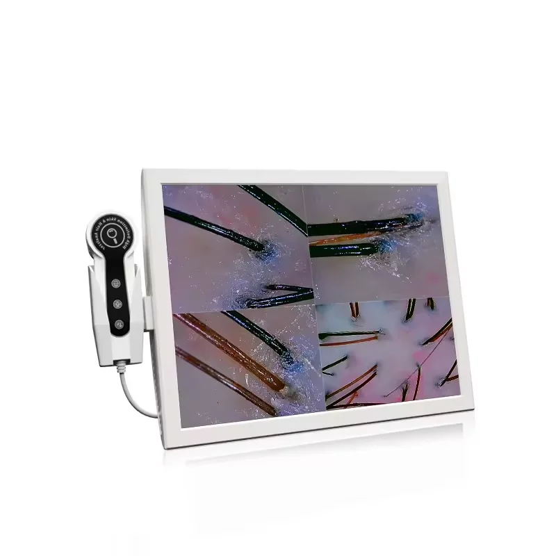 15 Inch HD Display 50/200X Professional Hair Follicle Detector Scalp Machine Oil Moisture Test Digital UV Skin Analysis Machine