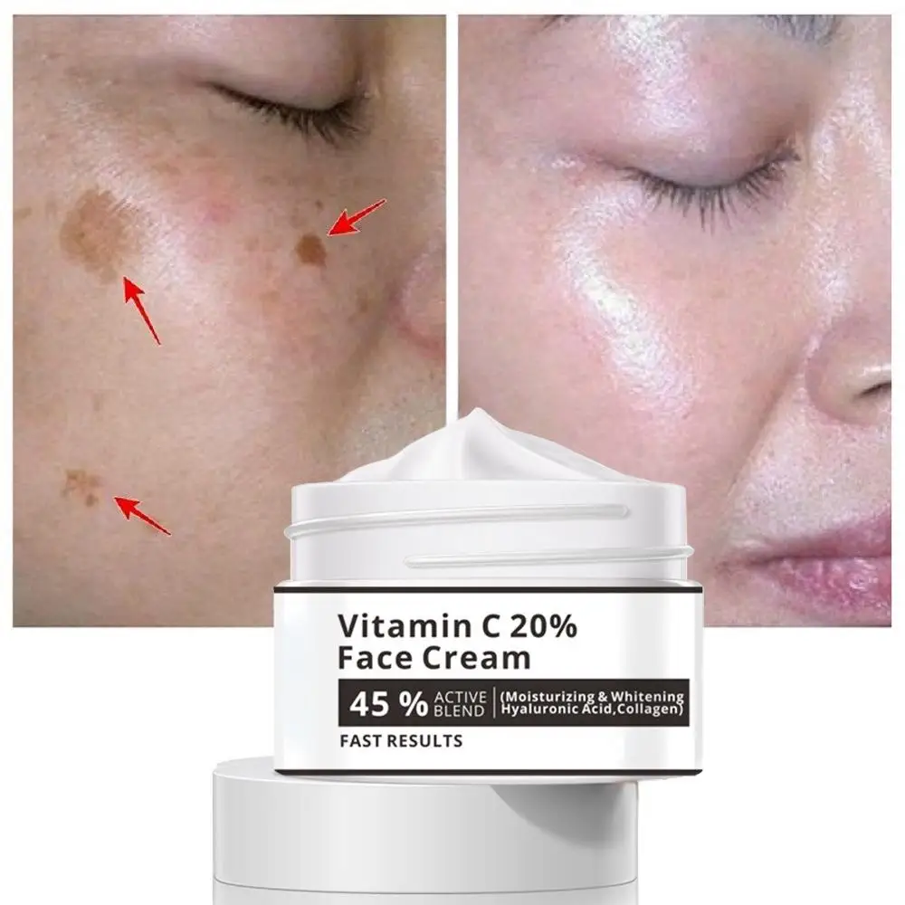 Effective Whitening Freckle Cream Remove Melasma Acne Spot Pigment Melanin Dark Spots Pigmentation Moisturizer Skin Care whitening freckle cream remove melasma dark spot acne marks lighten melanin pigmentation brightening moisturizing face skin care